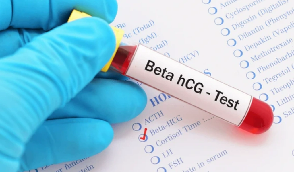 What Is the HCG Blood Pregnancy Test?